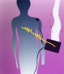 Bioelectrical Impedence Analysis