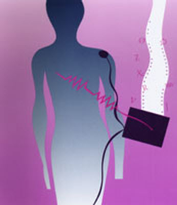 Bioelectrical Impedance Analysis