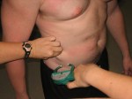 Measuring Body Fat With Calipers © (Imaged used with permission of owner)