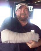 Me in my temporary splint the day after the accident