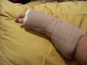 My arm-new splint ©2012